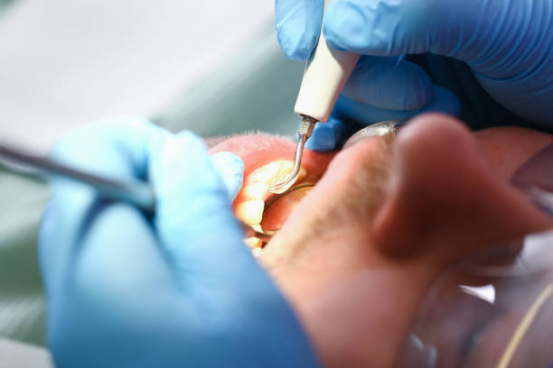 Best Emergency Treatment for Jaw Pain or Injury in Loretto, PA