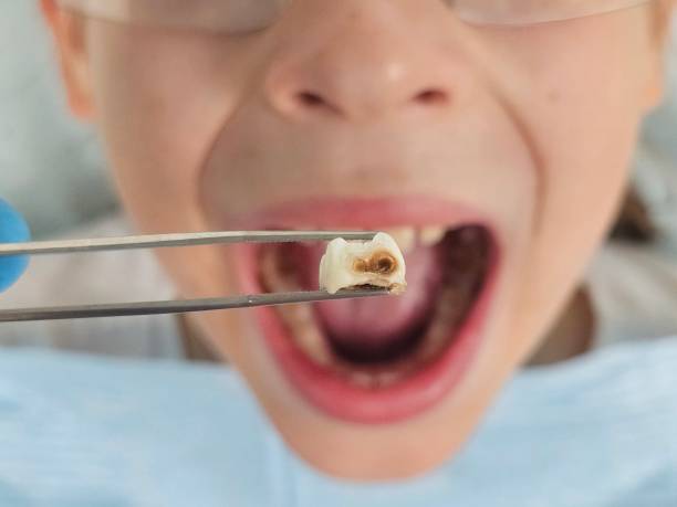 Best Emergency Pediatric Dental Care in Loretto, PA