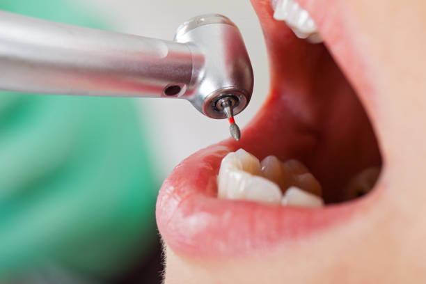 Best Walk-In Emergency Dental Services in Loretto, PA